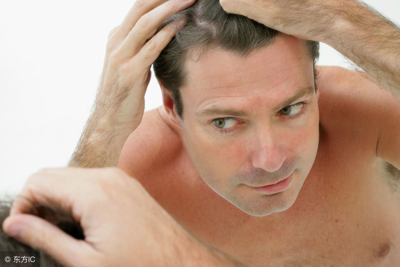 雄激素脱发用药,脱发的用药方案