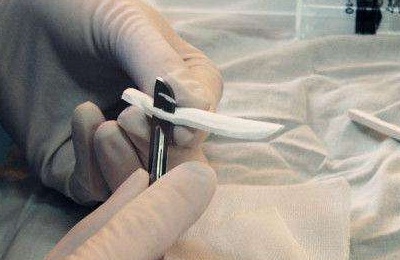 情人节“*力暴**亲热”！做过隆鼻后会被撞歪？