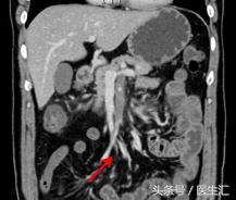 呕吐出咖啡色液体?别再忍着了!