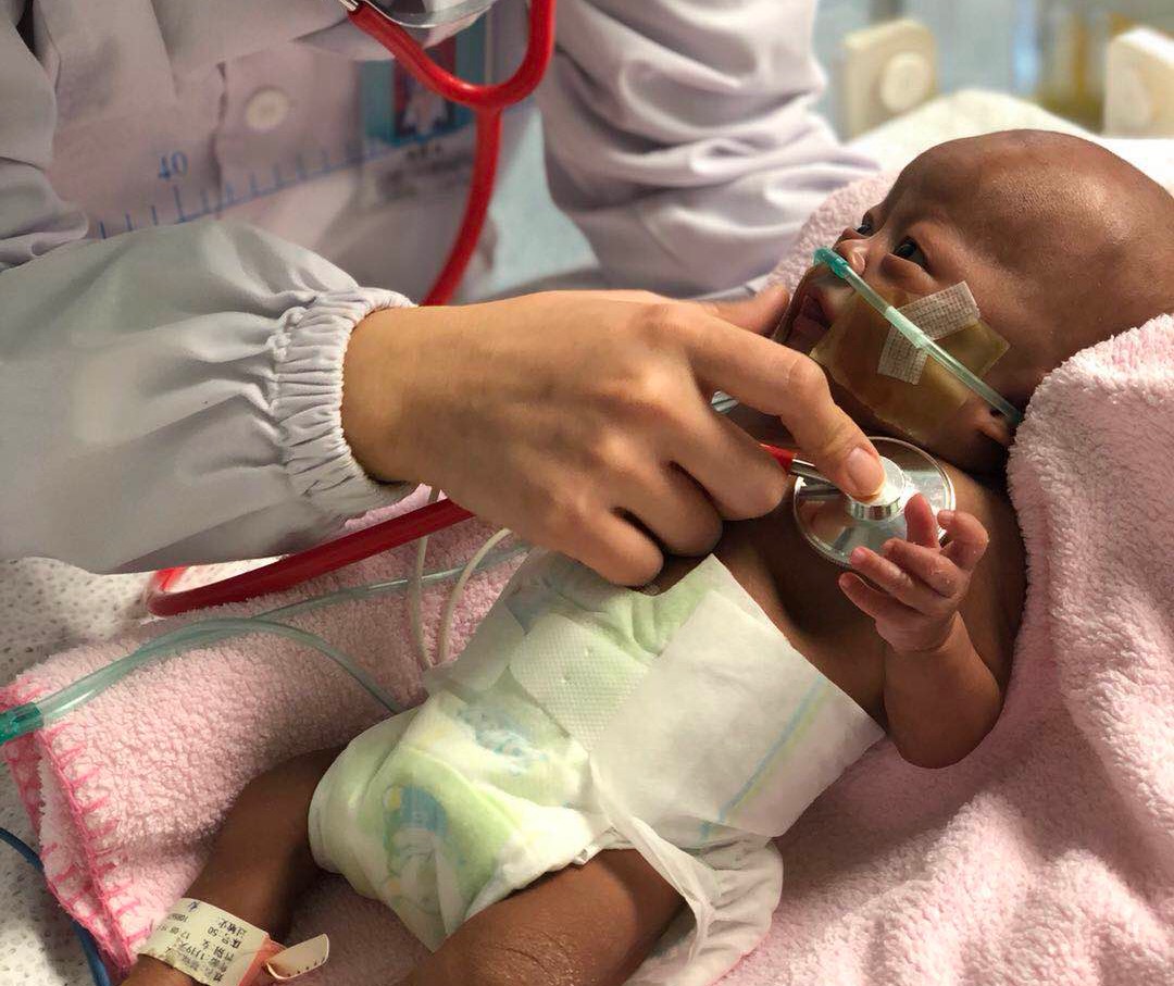 早产儿妈妈被安排袋鼠抱,早产儿抢救无效死亡