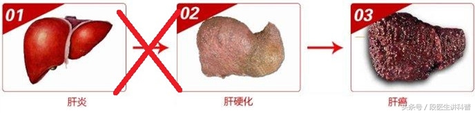 免疫性肝炎是什么病好治疗吗,十几年肝炎不治疗会有什么后果