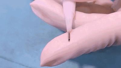 麦当劳薯条治疗脱发,麦当劳薯条掉头发