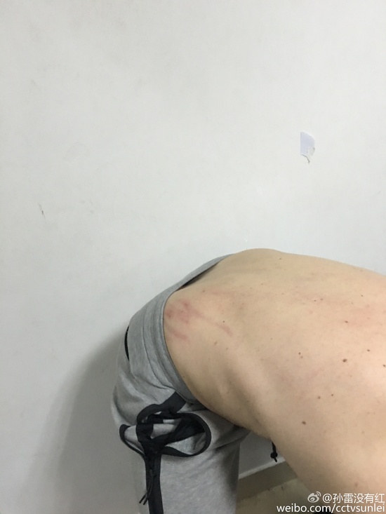 苏宁足球被打,江苏苏宁球员和对方发生冲突