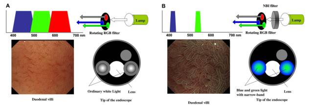 内镜检查痛苦吗,内镜检查是怎么做的