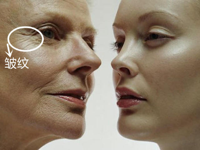 法令纹十大克星,法令纹的克星护肤品