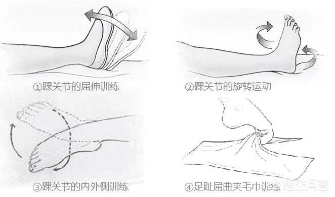 踝关节扭伤怎么知道韧带有没有断,踝关节扭伤的诊断