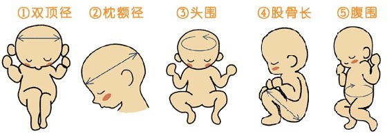 刚刚做完四维又要做三维,刚做完四维彩超为什么会出点血