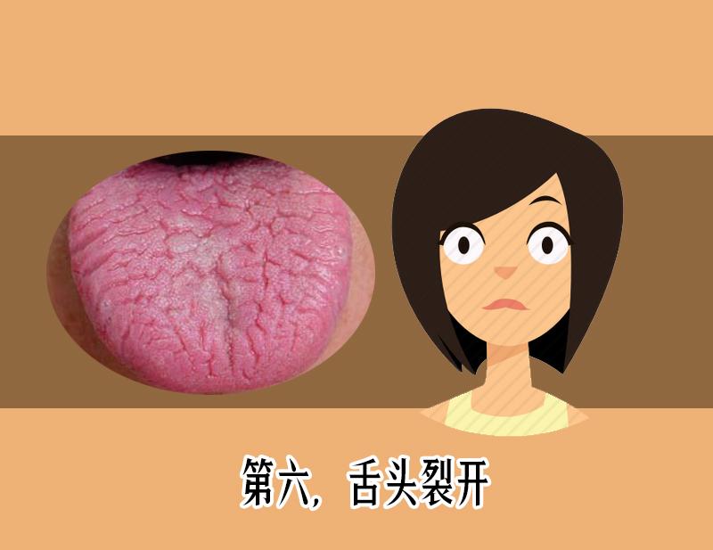 舌头鲜红有舌苔是怎么回事,舌头舌苔很厚变成黑色怎么回事