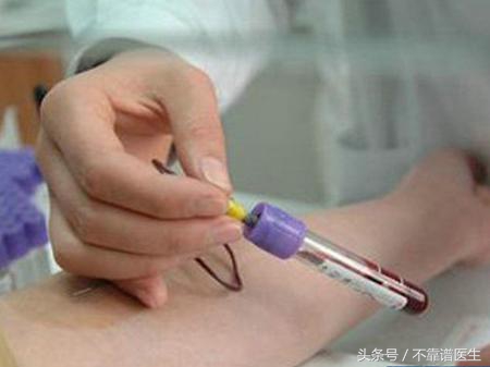 肌酐高的原因是什么,32岁肌酐157是肾脏病几期