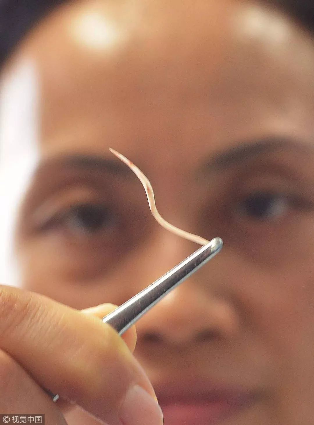 两岁孩子被父母用开水灌喉治病，偏方真会害死人