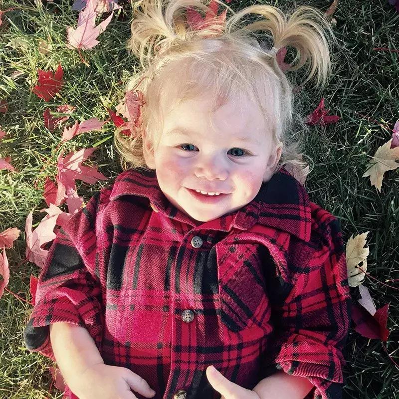 宝宝对净水器水过敏,对水过敏宝宝