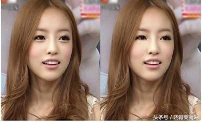 卧蚕会变成眼袋吗,卧蚕是怎么变成眼袋的