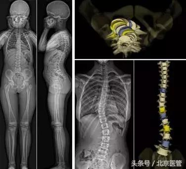 北京积水潭医院放射科设备怎么样,积水潭医院回龙观分院放射科