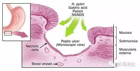 你知道你的胃有多强吗,你知道你的胃长什么样吗