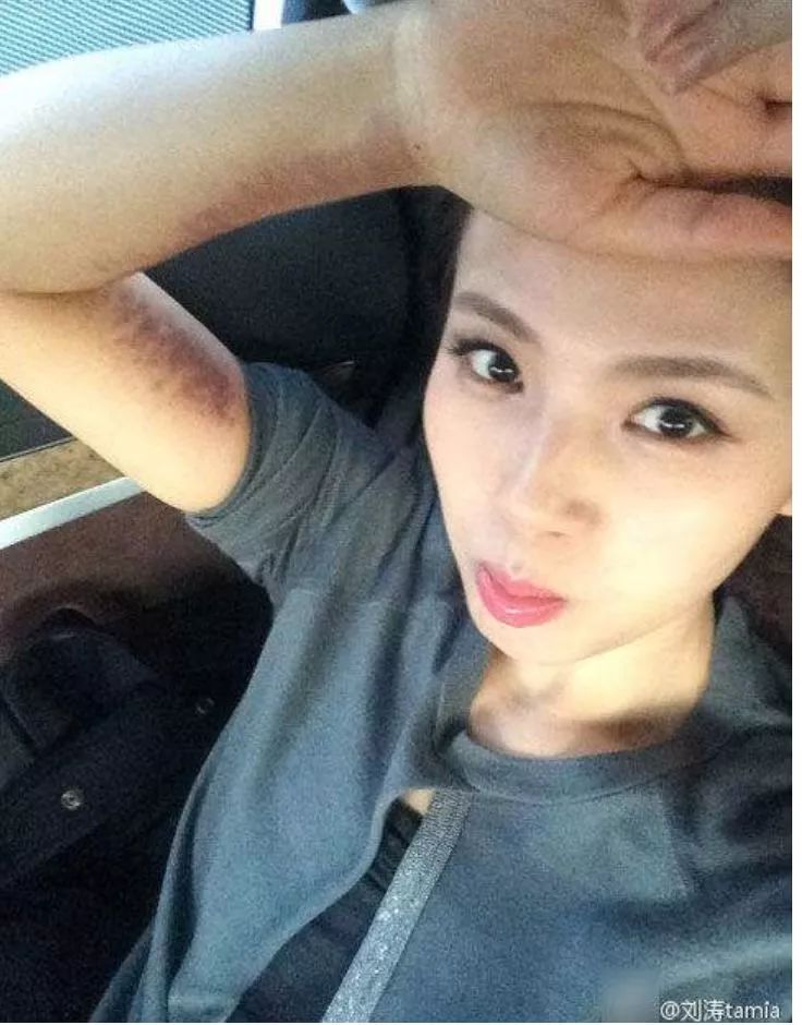 阿娇刮痧,阿娇刮痧养生视频