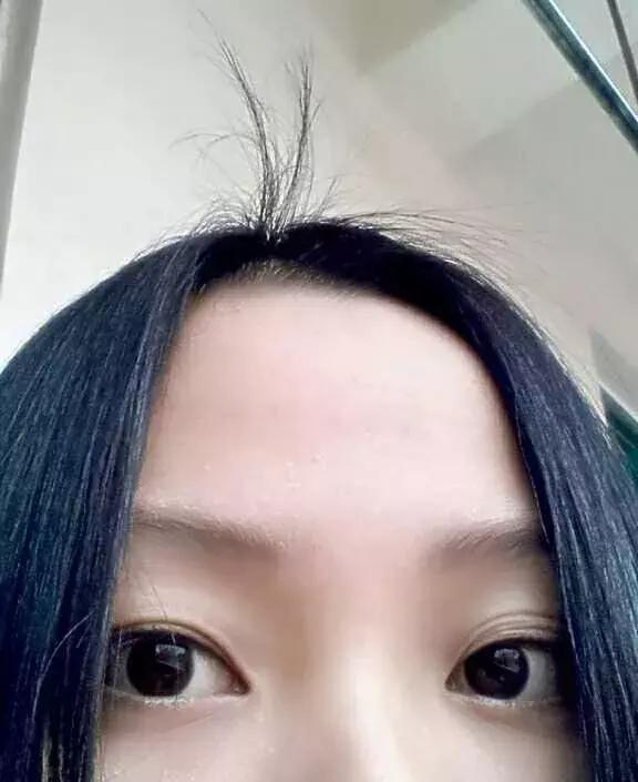 现实中真的有所谓的呆毛吗,呆毛在现实中真的会有吗