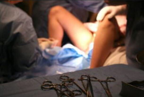 生孩子，是不是都要侧切？看看医生怎么说的