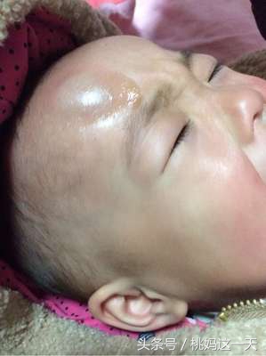 孩子脑门磕了大包最快的消肿方法,儿童头上磕个大包怎样消肿