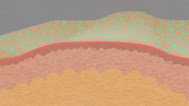 测评120秒去眼袋真的有用,百秒无痕去眼袋