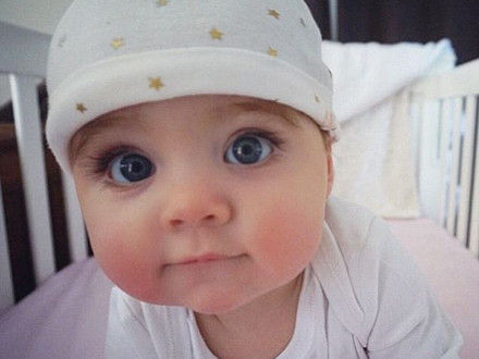 多动症频繁眨眼该怎么办,孩子频繁眨眼需要怎么干预