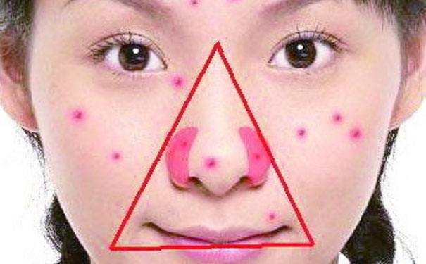 超级细菌,感染超级细菌的存活率