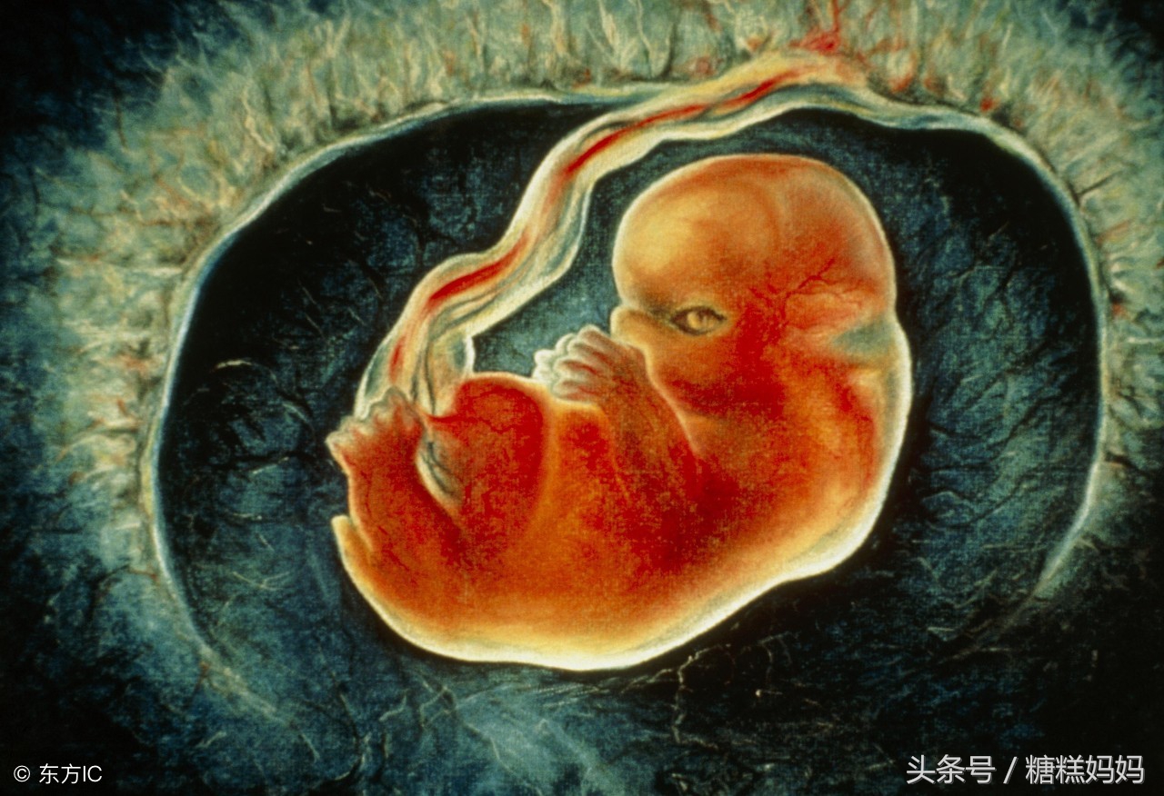 羊水绿色浑浊和黄色浑浊,分娩羊水2度浑浊到3度浑浊会多久