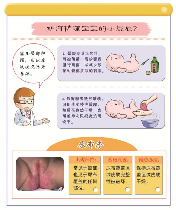 宝宝屁股常见的护理问题,宝宝臀部护理可涂什么