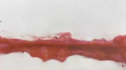 鸡病判断法,鸡的常见疾病及临床表现