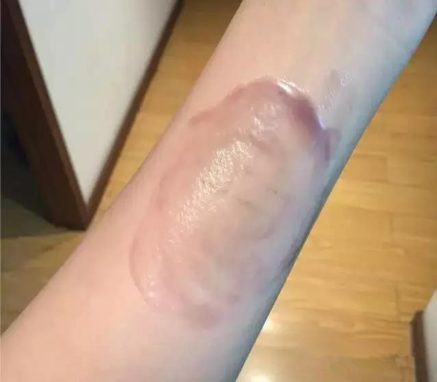 韩国芭妮兰卸妆膏新款真假,韩国卸妆膏芭妮兰怎么用