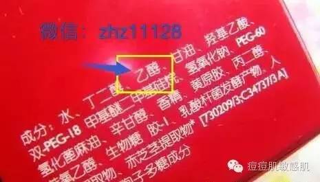 皮肤老是反复过敏是肝脏不好吗,激素依赖皮炎过敏怎样修复