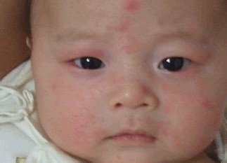 鸡蛋牛奶小麦大米过敏的宝宝辅食,过敏宝宝辅食添加时间顺序和种类