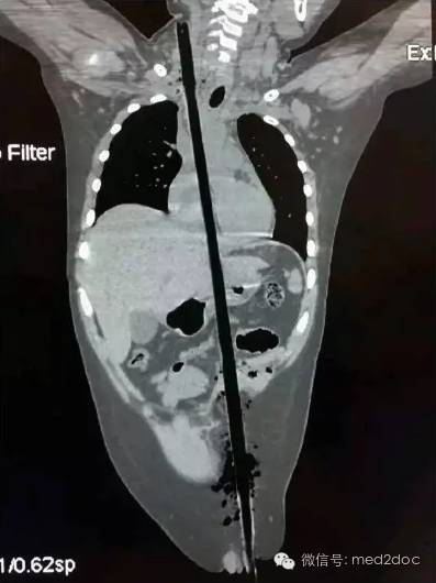 都伤成这样了还奇迹生还!向医生致敬!