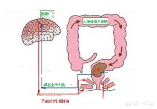 脑梗塞患者大便不通畅，饮食正常两周大便一次是什么原因引起的