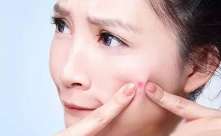 脸上痘痘最简单自愈方法,满脸痘痘治愈案例