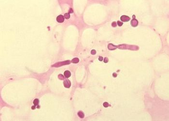 如果你的头上有很多头皮屑怎么办,头上有那么多的头皮屑为什么呢