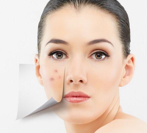 怎么去掉t区毛孔里的皮脂,出油黑头毛孔粗大解决方法