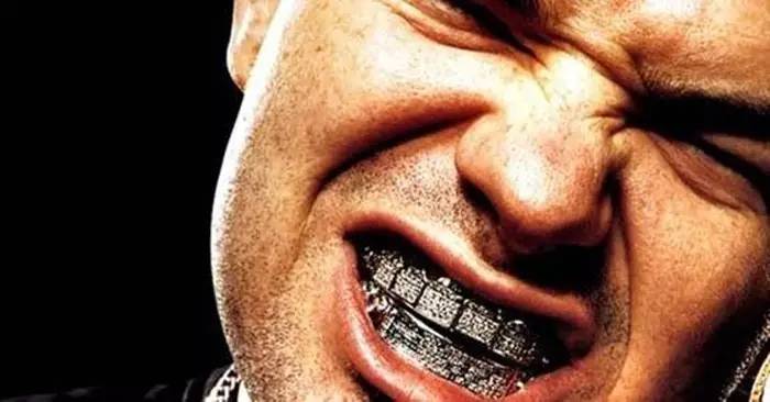 关于最近超火的金牙,你要知道这4件事(起码要知道怎么戴上去吧)