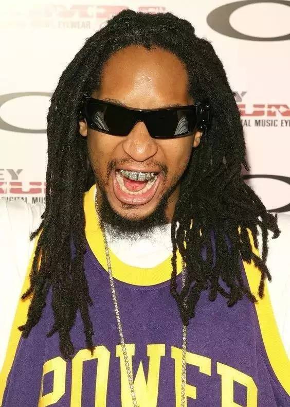 关于最近超火的金牙,你要知道这4件事(起码要知道怎么戴上去吧)