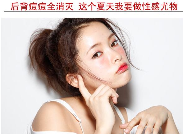 后背长痘痘的原因及解决办法,后背长痘痘的快速解决方法