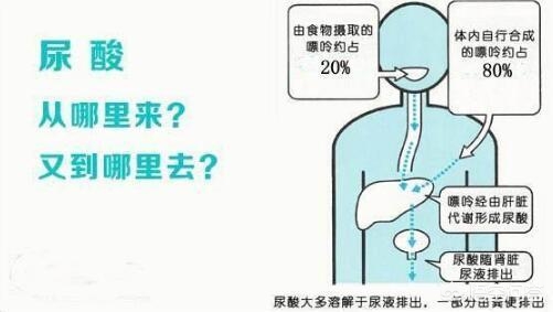 阿司匹林引起尿酸高怎么办,阿司匹林引起尿酸高多久能降下来