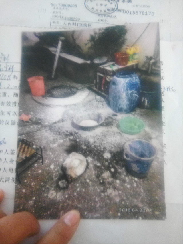 煤气罐爆炸小孩被炸伤,煤气爆炸21岁女孩被烧伤后续