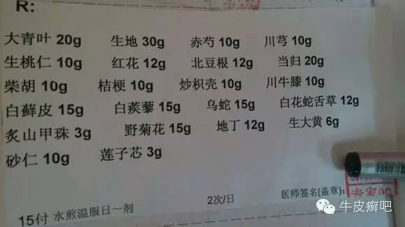 医院专家教你治疗牛皮癣,专家专治牛皮癣方法