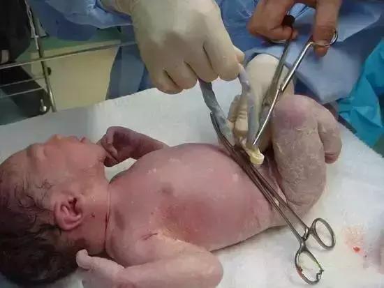 顺产分娩全过程想顺产的你一定想知道！