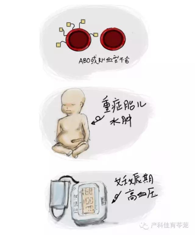 羊水过多和过少的原因,怎么预防羊水过多或过少