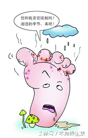 男性14岁趾间糜烂型脚气脱皮现象,脚上脱皮水泡痒脚趾缝溃烂