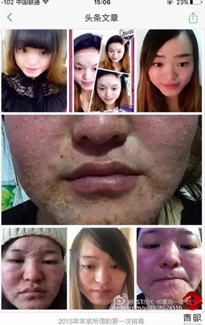 张庭的护肤品毁脸，张馨予、郭德纲自创的就靠谱吗？