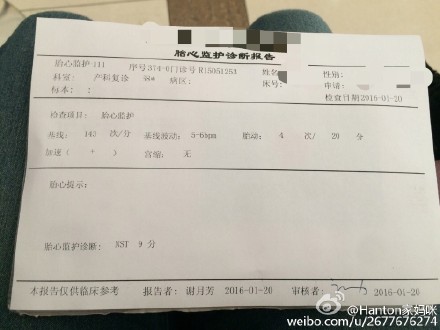 胎儿入盆胎监是不是很平稳,胎儿入盆了但是胎头高