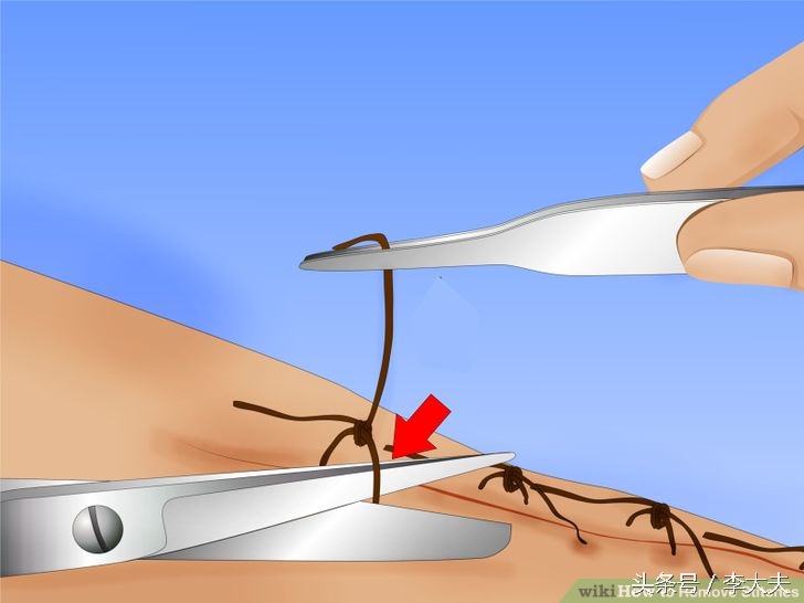 脑洞大开手术,脑洞大开手术后获得超能力