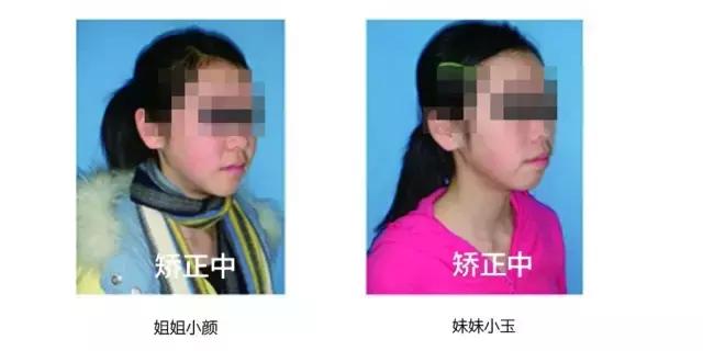 正畸专家介绍图,正畸医生关于整牙的10条建议