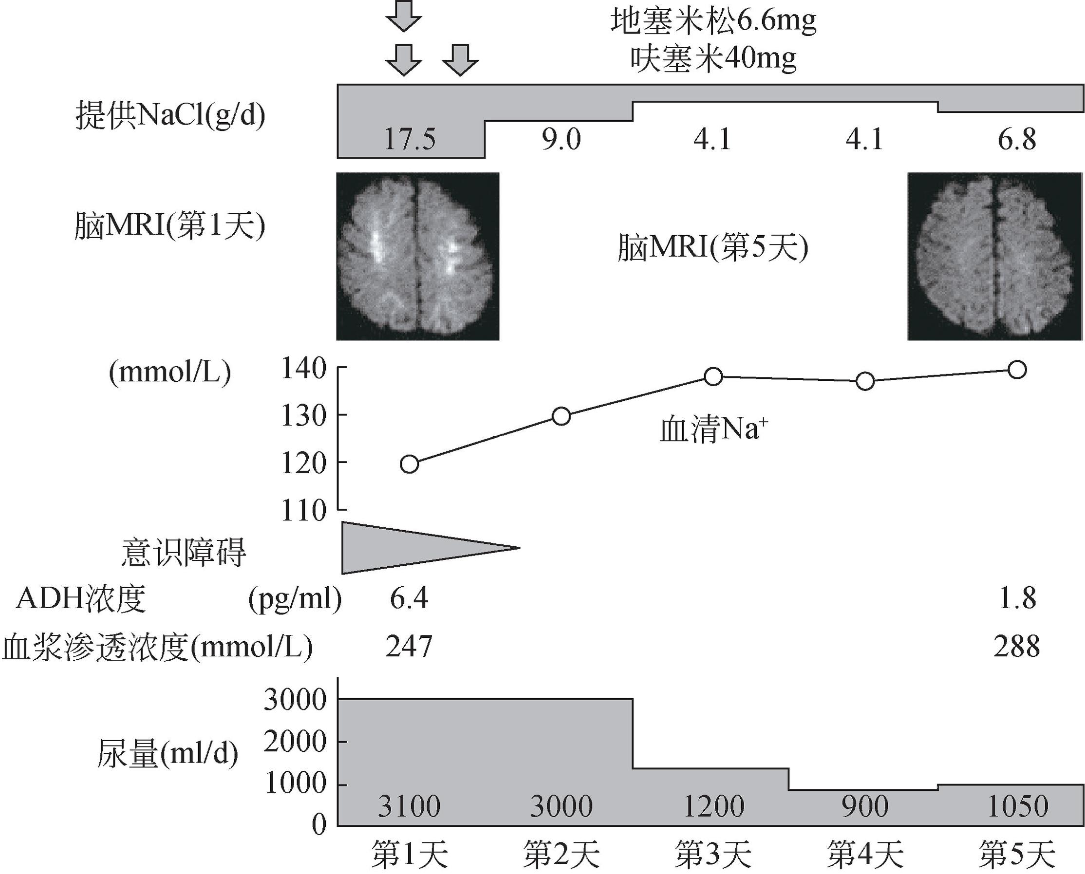 夏季饮水，准妈妈们不要“一次喝个够”